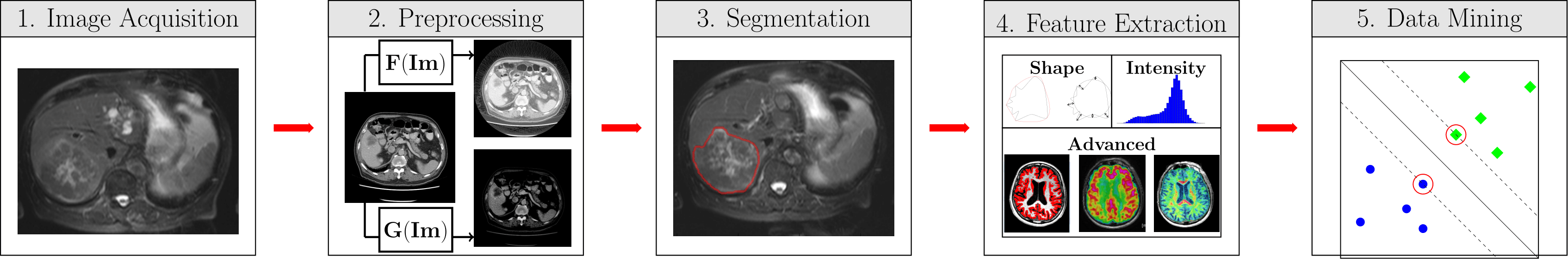 ../_images/RadiomicsSteps.png